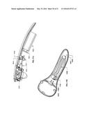 Stand-Mounted Scanned Laser Vein Contrast Enhancer diagram and image