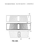 Athletic Band with Removable Module diagram and image