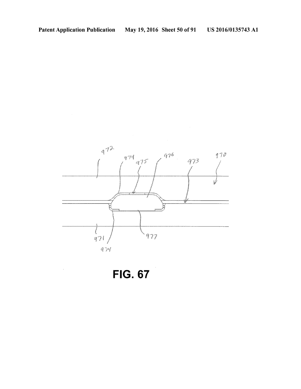 Athletic Band with Removable Module - diagram, schematic, and image 51