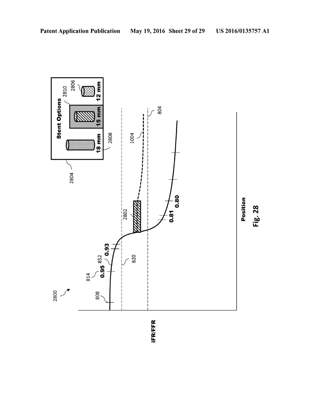 PERCUTANEOUS CORONARY INTERVENTION (PCI) PLANNING INTERFACE WITH PRESSURE     DATA AND VESSEL DATA AND ASSOCIATED DEVICES, SYSTEMS, AND METHODS - diagram, schematic, and image 30