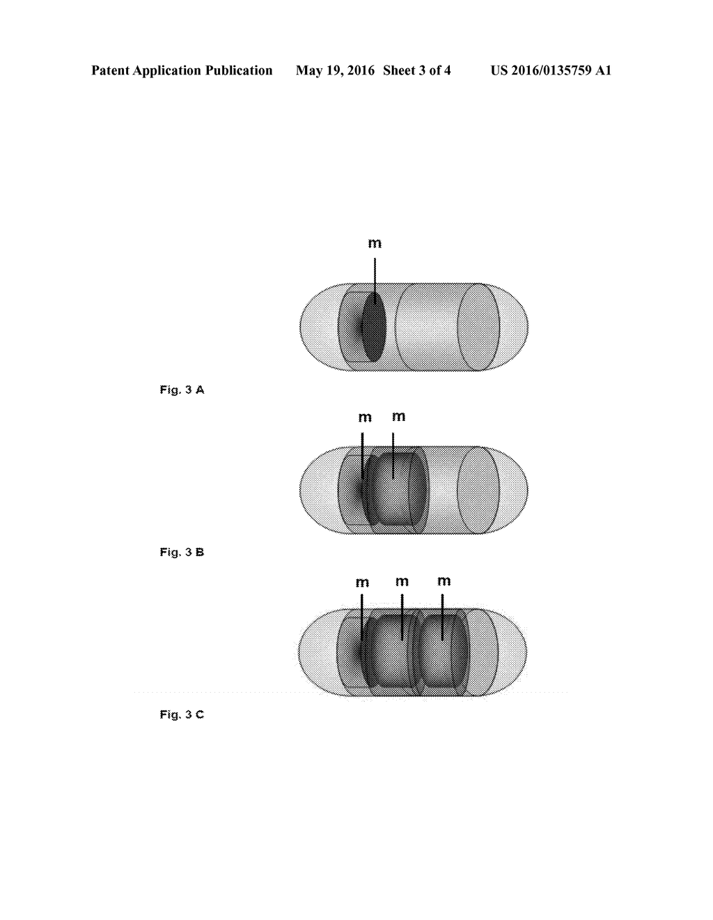 PERSONALIZED DETECTION SYSTEM FOR DETECTING MAGNETIC OBJECTS IN THE HUMAN     ORGANISM - diagram, schematic, and image 04