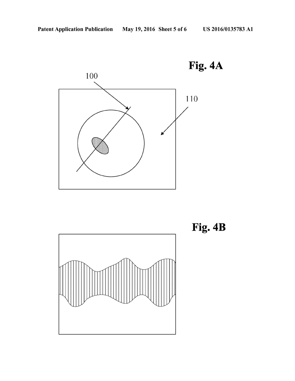 M-MODE ULTRASOUND IMAGING OF ARBITRARY PATHS - diagram, schematic, and image 06