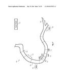 PERCUTANEOUS CORONARY INTERVENTION (PCI) PLANNING INTERFACE AND ASSOCIATED     DEVICES, SYSTEMS, AND METHODS diagram and image