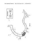 PERCUTANEOUS CORONARY INTERVENTION (PCI) PLANNING INTERFACE AND ASSOCIATED     DEVICES, SYSTEMS, AND METHODS diagram and image