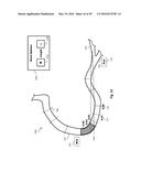 PERCUTANEOUS CORONARY INTERVENTION (PCI) PLANNING INTERFACE AND ASSOCIATED     DEVICES, SYSTEMS, AND METHODS diagram and image