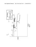 PERCUTANEOUS CORONARY INTERVENTION (PCI) PLANNING INTERFACE AND ASSOCIATED     DEVICES, SYSTEMS, AND METHODS diagram and image