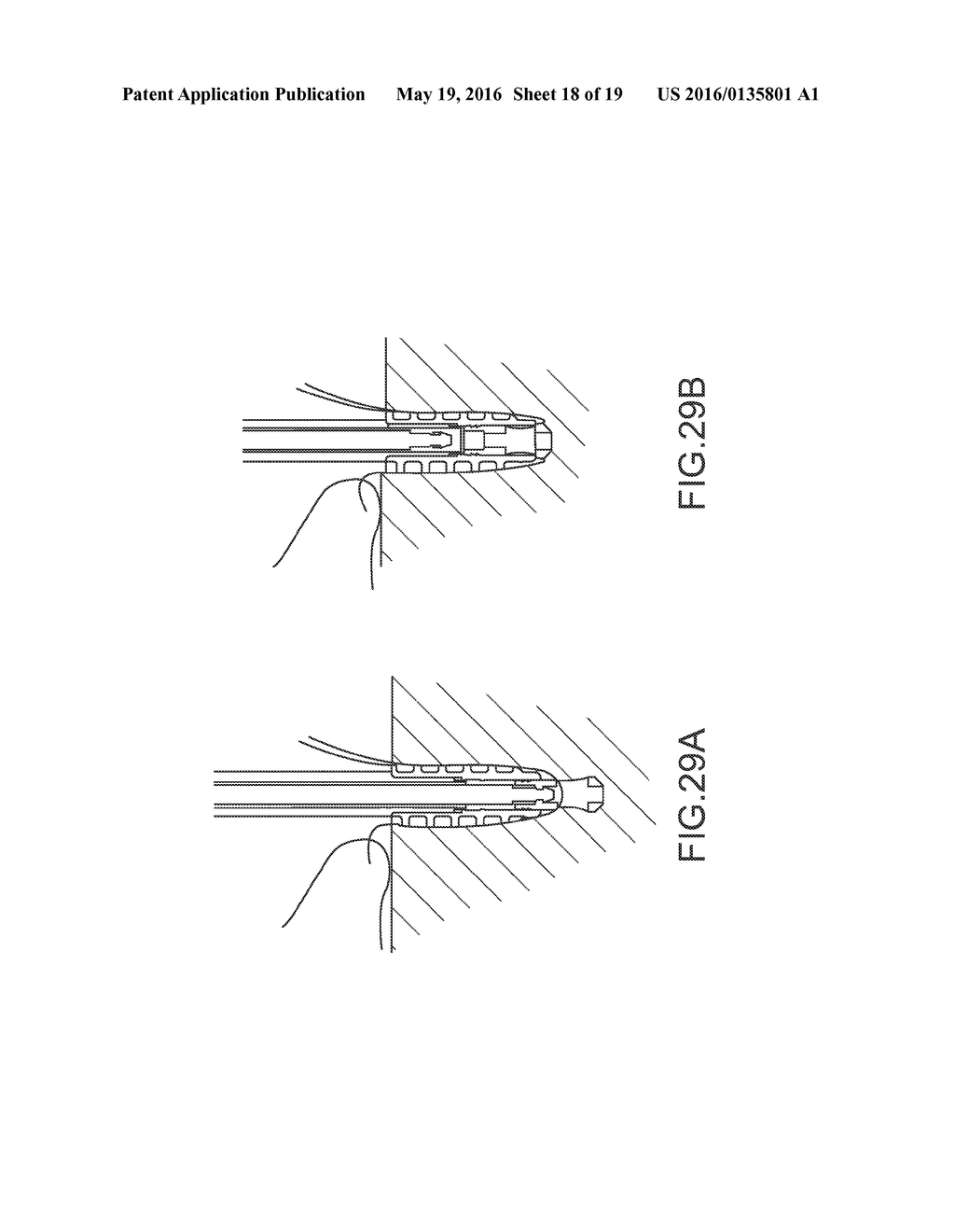 THREADED KNOTLESS ANCHOR - diagram, schematic, and image 19