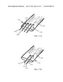 Methods for Passing Multiple Sutures Through Tissue diagram and image