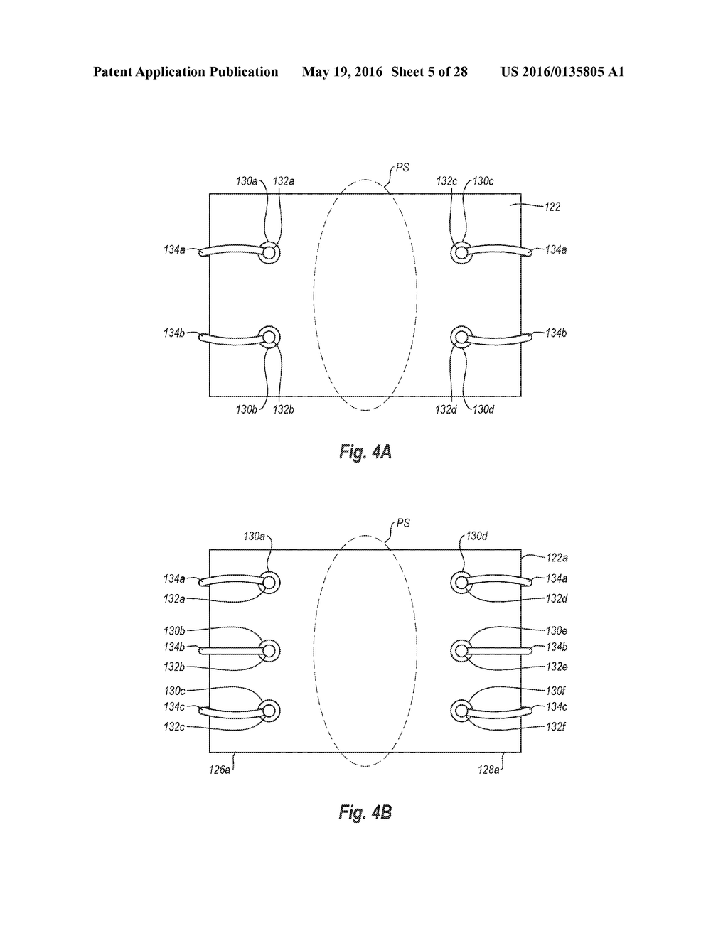 SYSTEMS, METHODS, AND DEVICES FOR CLOSING HOLES IN BODY LUMENS - diagram, schematic, and image 06