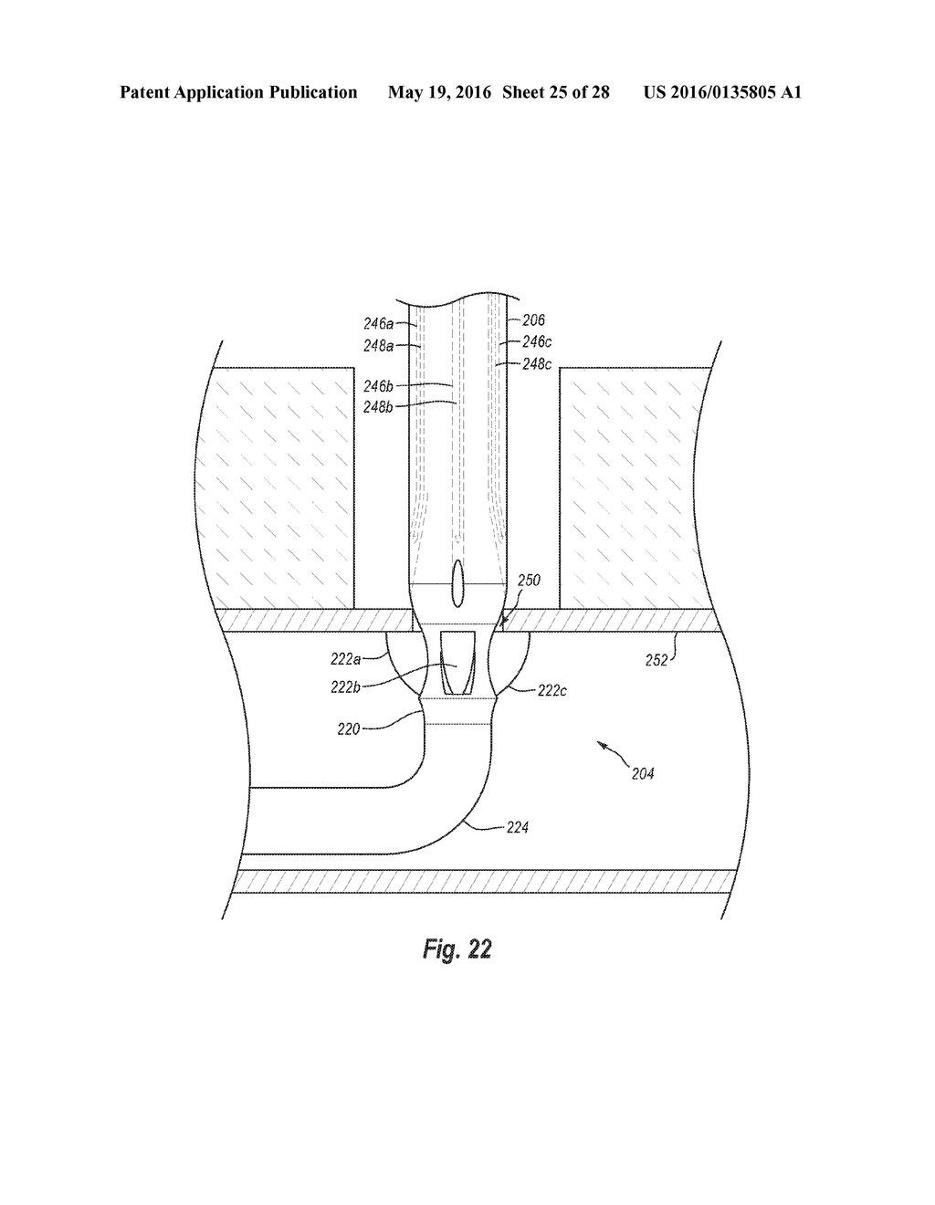 SYSTEMS, METHODS, AND DEVICES FOR CLOSING HOLES IN BODY LUMENS - diagram, schematic, and image 26