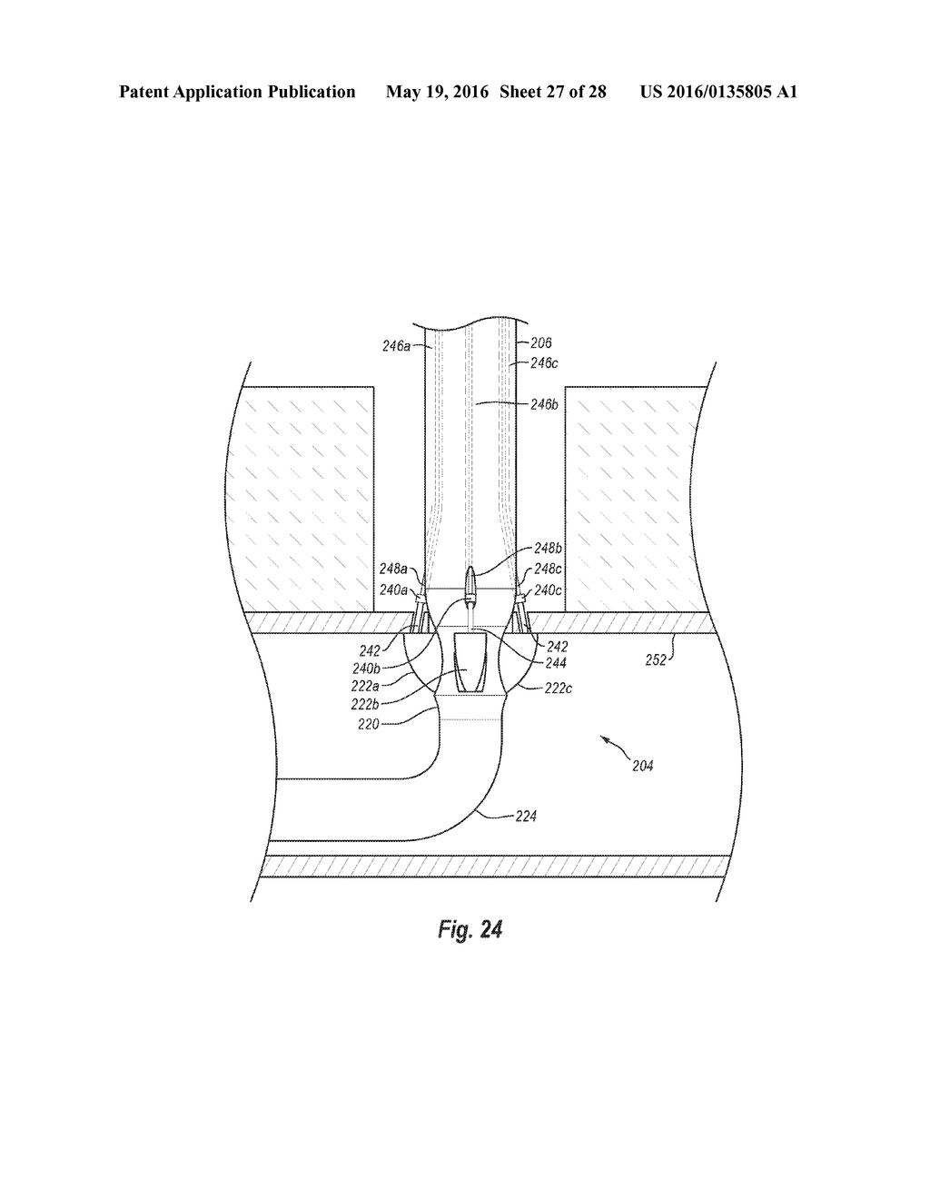 SYSTEMS, METHODS, AND DEVICES FOR CLOSING HOLES IN BODY LUMENS - diagram, schematic, and image 28