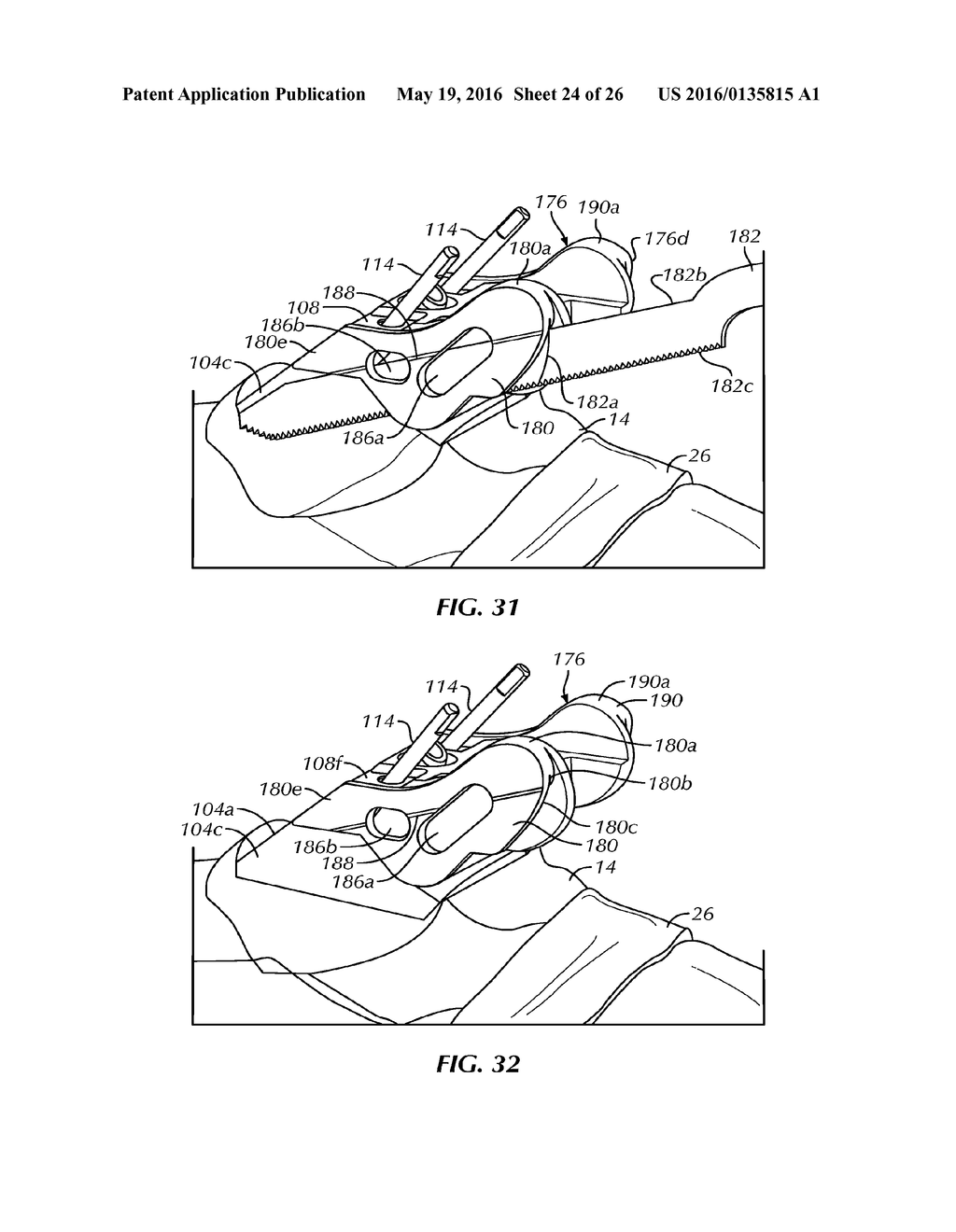 SURGICAL INSTRUMENTATION AND METHODS OF USE FOR IMPLANTING A PROSTHESIS - diagram, schematic, and image 25