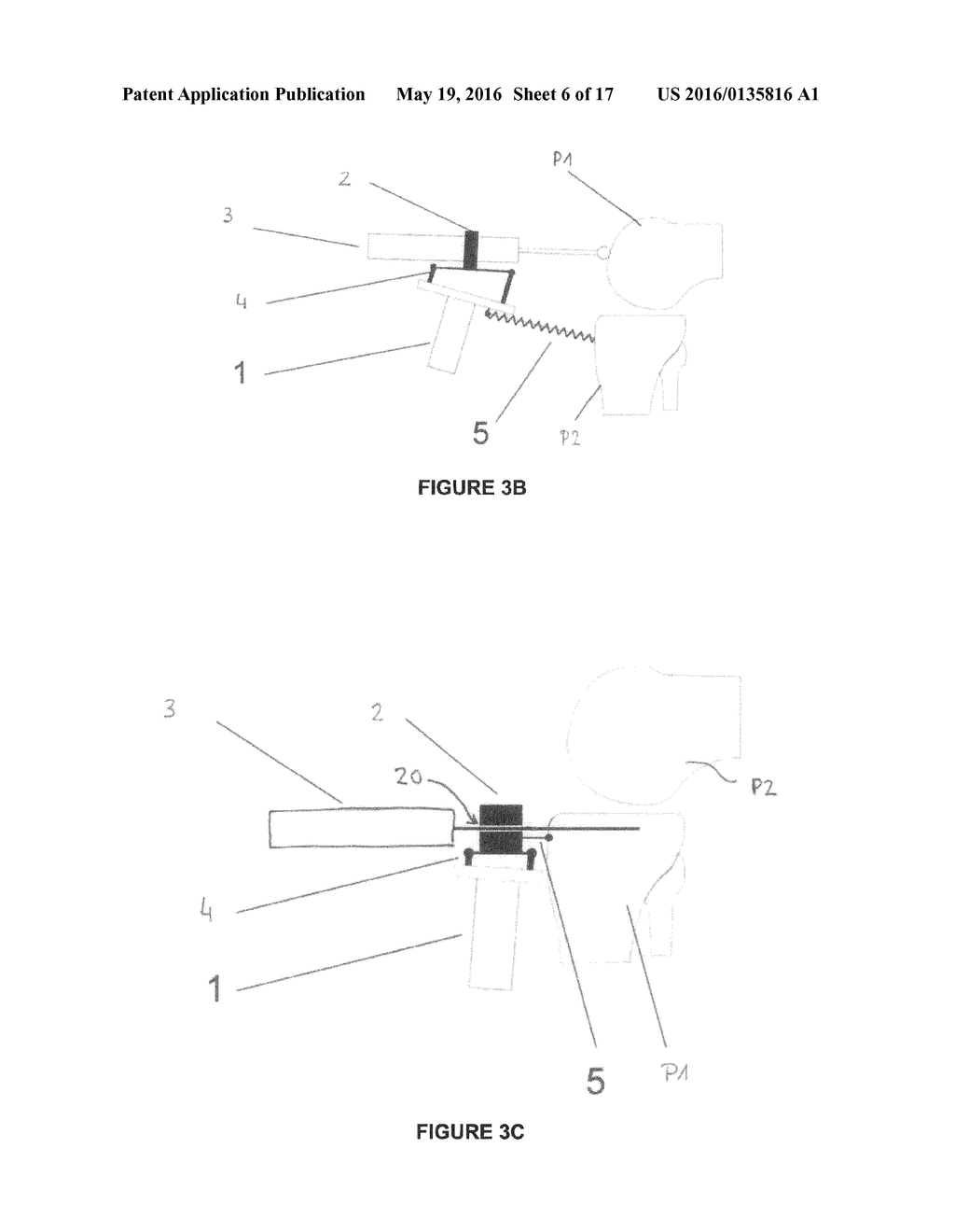 SYSTEM FOR POSITIONING A SURGICAL DEVICE - diagram, schematic, and image 07