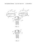 ACETABULAR REAMER ASSEMBLY diagram and image