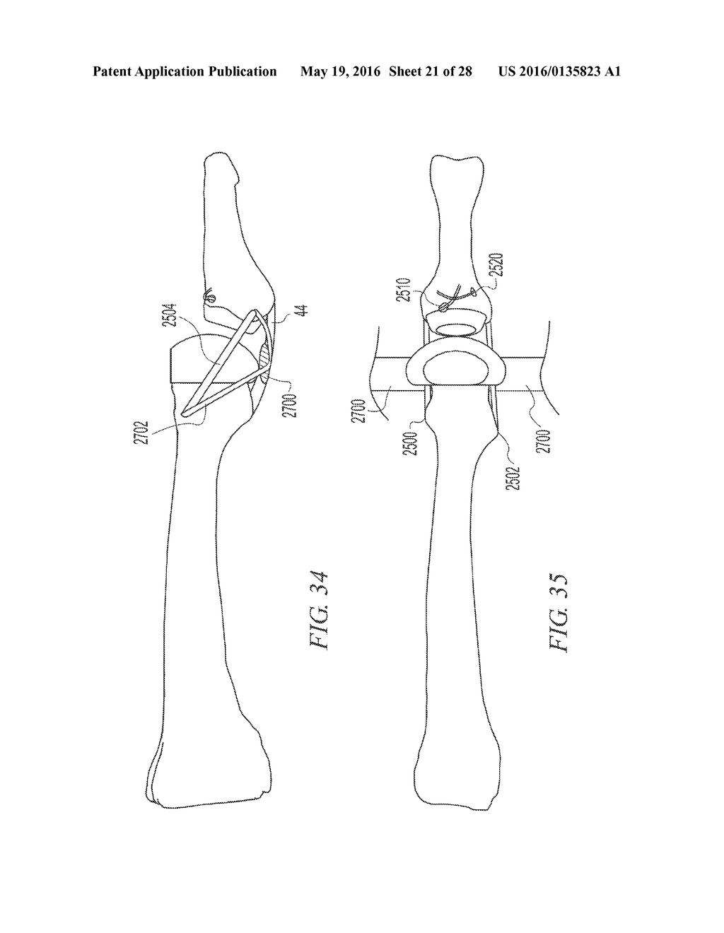 SOFT TISSUE RECONSTRUCTION - diagram, schematic, and image 22