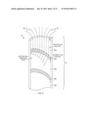 SYSTEMS AND METHODS FOR EN BLOC REMOVAL OF UNDESIRABLE MATERIAL FROM     PASSAGEWAYS diagram and image