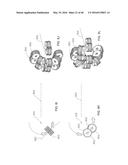 MINIMALLY INVASIVE MICRO TISSUE DEBRIDERS HAVING TARGETED ROTOR POSITIONS diagram and image