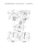 TISSUE ACCESS SITE SYSTEM AND METHOD diagram and image