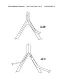 TISSUE ACCESS SITE SYSTEM AND METHOD diagram and image