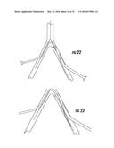 TISSUE ACCESS SITE SYSTEM AND METHOD diagram and image