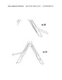 TISSUE ACCESS SITE SYSTEM AND METHOD diagram and image