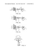 DEVICES AND METHODS FOR TISSUE ACCESS diagram and image