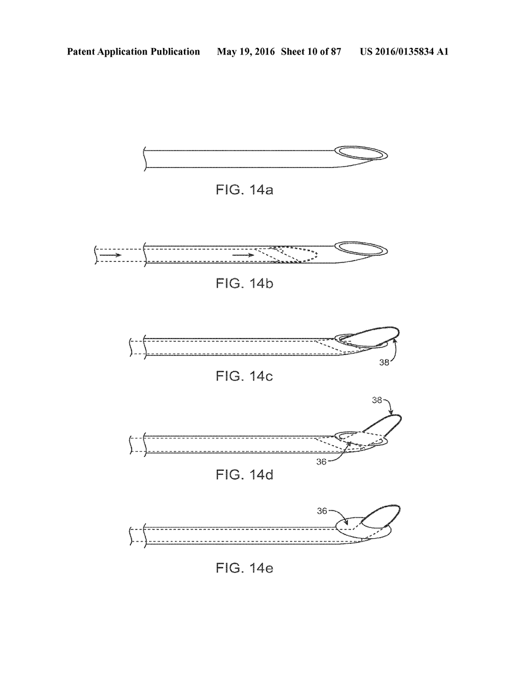 DEVICES AND METHODS FOR TISSUE ACCESS - diagram, schematic, and image 11