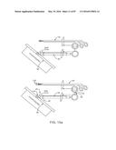 DEVICES AND METHODS FOR TISSUE ACCESS diagram and image