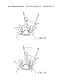 DEVICES AND METHODS FOR TISSUE ACCESS diagram and image