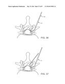 DEVICES AND METHODS FOR TISSUE ACCESS diagram and image