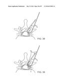 DEVICES AND METHODS FOR TISSUE ACCESS diagram and image