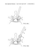 DEVICES AND METHODS FOR TISSUE ACCESS diagram and image