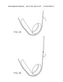 DEVICES AND METHODS FOR TISSUE ACCESS diagram and image