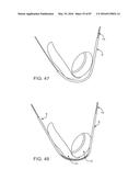 DEVICES AND METHODS FOR TISSUE ACCESS diagram and image