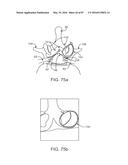 DEVICES AND METHODS FOR TISSUE ACCESS diagram and image