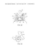 DEVICES AND METHODS FOR TISSUE ACCESS diagram and image