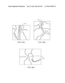 DEVICES AND METHODS FOR TISSUE ACCESS diagram and image