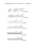 DEVICES AND METHODS FOR TISSUE ACCESS diagram and image