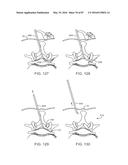 DEVICES AND METHODS FOR TISSUE ACCESS diagram and image