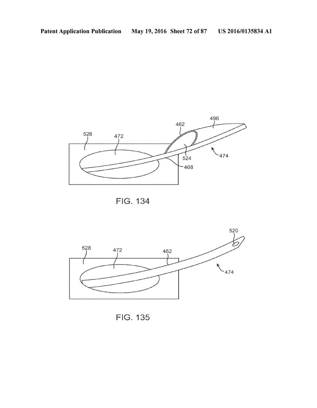 DEVICES AND METHODS FOR TISSUE ACCESS - diagram, schematic, and image 73