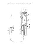 TEMPORARY VASCULAR SCAFFOLD AND SCORING DEVICE diagram and image