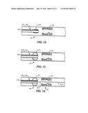 TEMPORARY VASCULAR SCAFFOLD AND SCORING DEVICE diagram and image