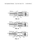 TEMPORARY VASCULAR SCAFFOLD AND SCORING DEVICE diagram and image