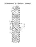 TEMPORARY VASCULAR SCAFFOLD AND SCORING DEVICE diagram and image