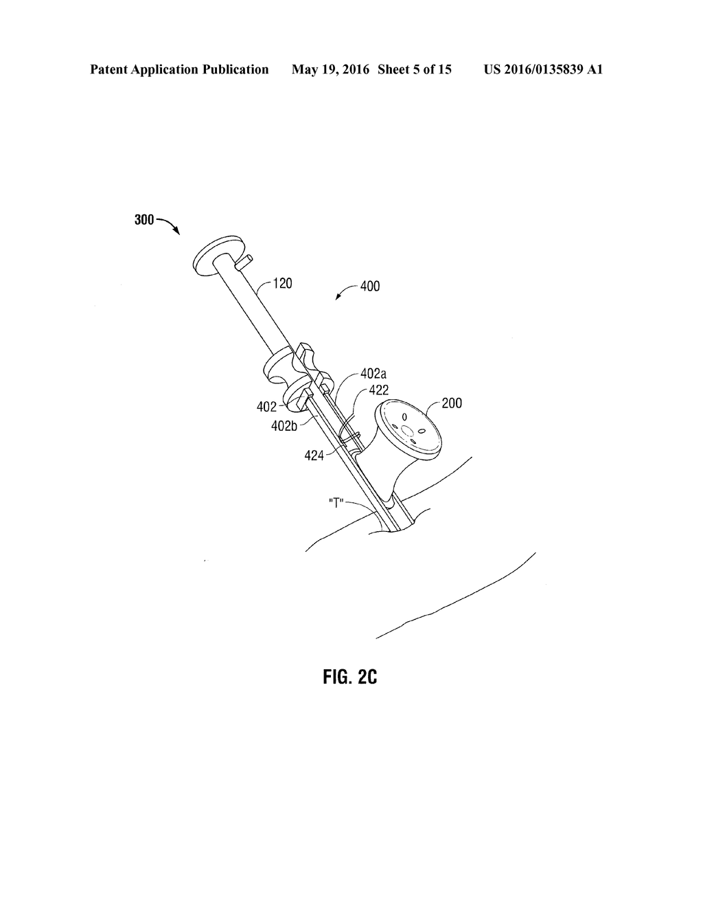 SURGICAL INTRODUCER AND ACCESS PORT ASSEMBLY - diagram, schematic, and image 06