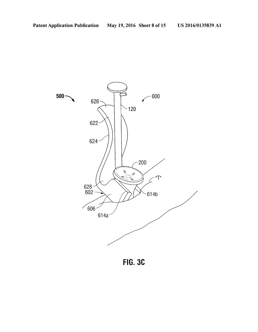 SURGICAL INTRODUCER AND ACCESS PORT ASSEMBLY - diagram, schematic, and image 09