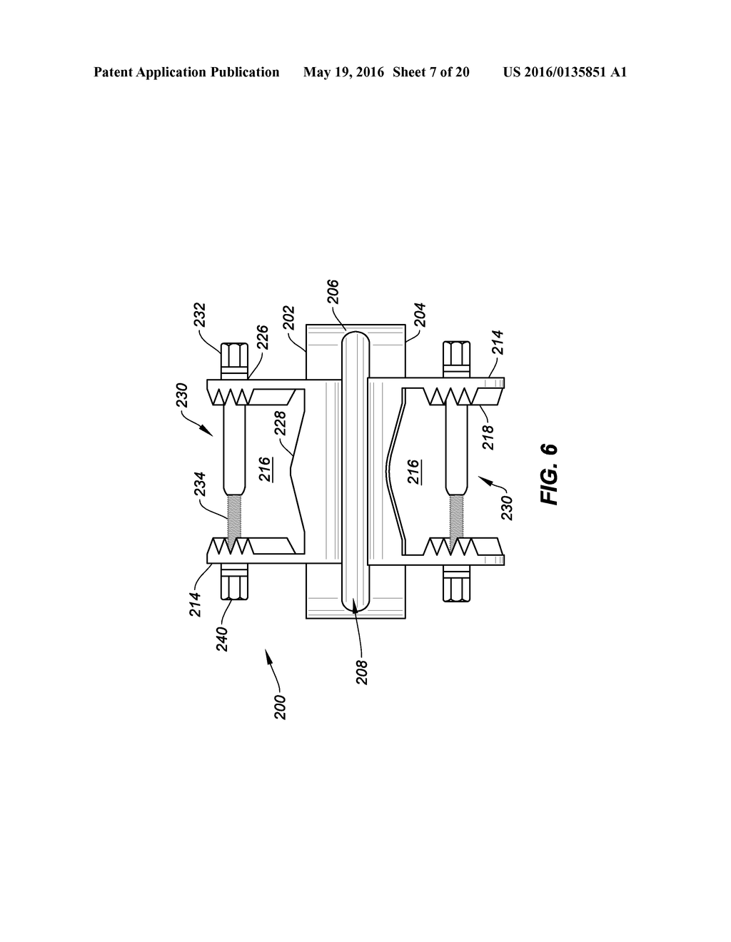 INTERLAMINAR, INTERSPINOUS STABILIZATION DEVICES FOR THE CERVICAL SPINE - diagram, schematic, and image 08