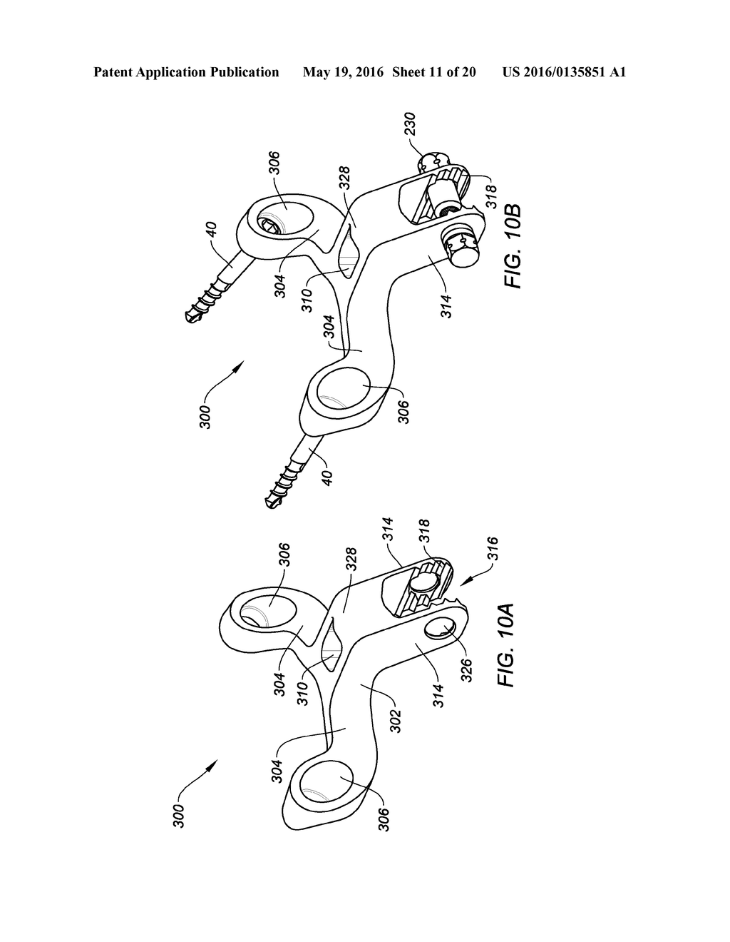 INTERLAMINAR, INTERSPINOUS STABILIZATION DEVICES FOR THE CERVICAL SPINE - diagram, schematic, and image 12