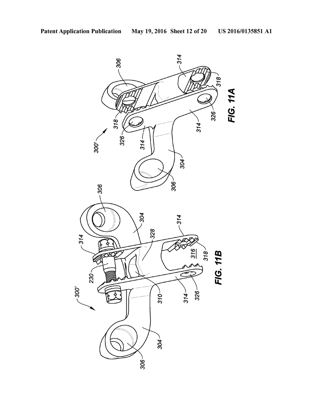 INTERLAMINAR, INTERSPINOUS STABILIZATION DEVICES FOR THE CERVICAL SPINE - diagram, schematic, and image 13