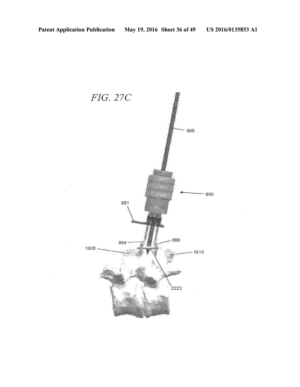 MINIMALLY INVASIVE TOOLING FOR DELIVERY OF INTERSPINOUS SPACER - diagram, schematic, and image 37